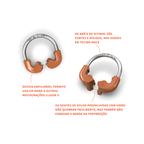 Halo Sistemas de Matriz Seccional - Kit Standard - Ultradent