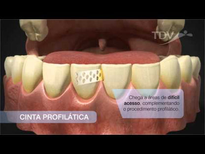 Fita de Aço - Cinta Profilática - TDV